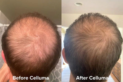 Celluma RESTORE