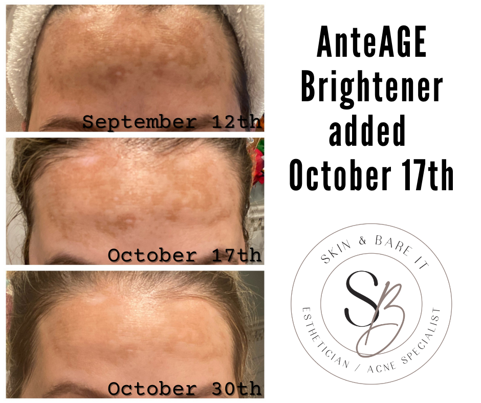 [M&M]CrystalEXTRA Essence30ml美整潤アンチエージング AnteAGE MDX Biosome Brightener – Skin & Bare It | Esthetician and